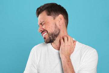 Naklejka premium Man with rash suffering from monkeypox virus on light blue background