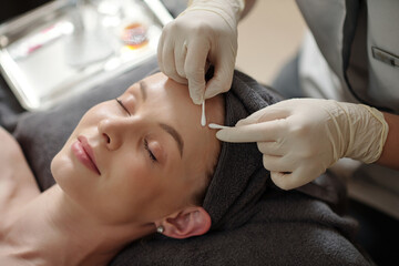 Young woman getting acne treatment procedure in spa salon
