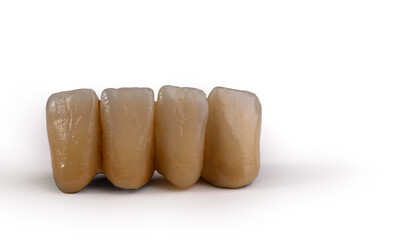 The Perfect Smile: Enhancing Dental Aesthetics with Brown Crowns