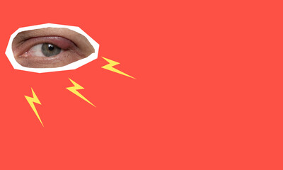 Contemporary art collage of sparks from the eye on a red background.