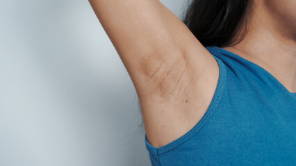 Young confident asian chinese female armpit with blue tank top isolated background.