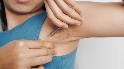 Use tweezers to pull armpit hairs. Young confident asian chinese female armpit with blue tank top isolated background.