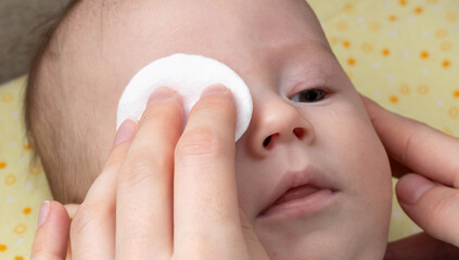 The mother washes the child's eyes with a cotton pad. Eye care and hygiene for newborns.