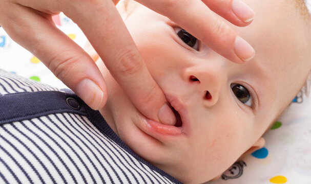 A mother massages the gums of a baby boy during the eruption of the first teeth, close-up