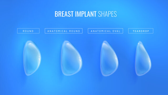 Types of breast implant for plastic surgery in a realistic style. Infographic concept for plastic surgery clinic banner. Vector illustration in futuristic style with light effects