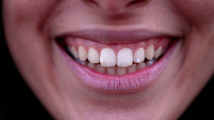 Happy woman lips smiling macro close up detail. Female Person mouth and lip in wide smile