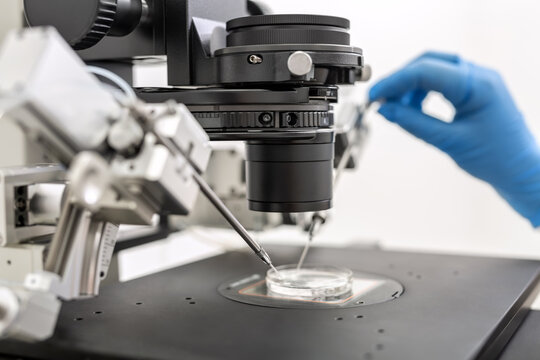 Process of in vitro fertilization in laboratory