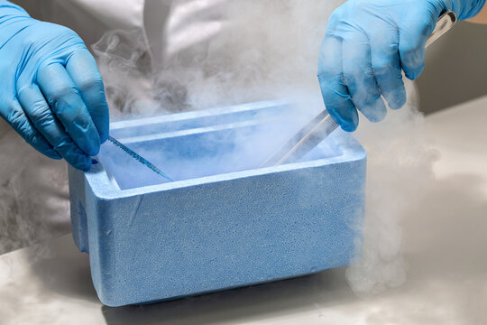 Process of in vitro fertilization in laboratory