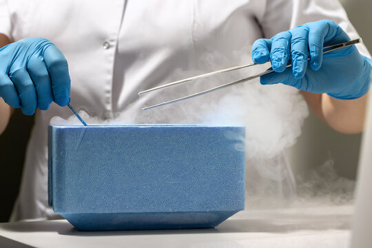 Process of in vitro fertilization in laboratory