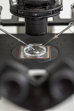 Process of in vitro fertilization in laboratory