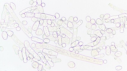 Neurospora sp. under microscope. Sample collected from corncob. Fresh sample without staining. Selective focus