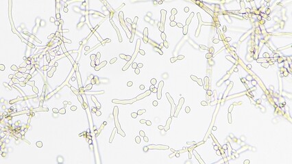 Neurospora sp. under microscope. Sample collected from corncob. Fresh sample without staining. Selective focus © Ekky