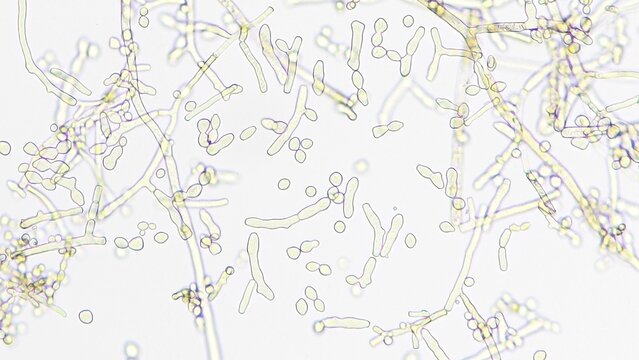 Neurospora sp. under microscope. Sample collected from corncob. Fresh sample without staining. Selective focus