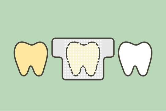 tooth whitening, yellow tooth used teeth whitening strip to whiten - dental cartoon vector flat style