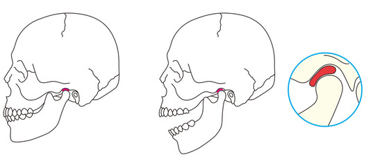 正常な顎関節の構造 - obrazy, fototapety, plakaty