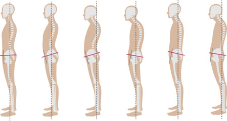 良い姿勢と悪い姿勢の男性骨格見本 - obrazy, fototapety, plakaty