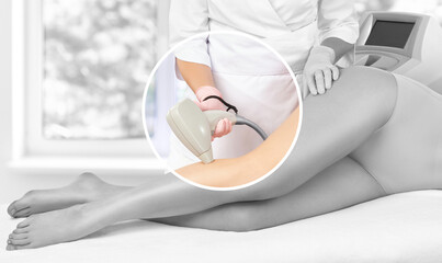 Elos epilation hair removal procedure on a woman’s body. Beautician doing laser rejuvenation in a beauty salon. Removing unwanted body hair. Hardware ipl cosmetology