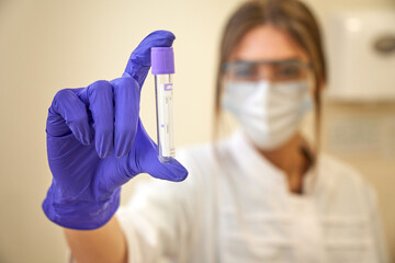 A young female scientist or doctor is holding a tube for virus analysis. Innovations in medicine. Medicine of the future.