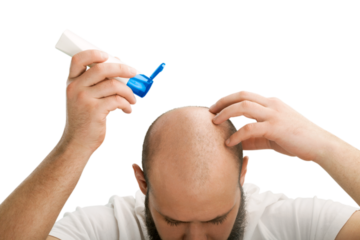 Young man hair loss problem for health care shampoo