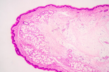 Anatomy and Histological Bone, Elastic cartilage human and Joint of human foetus under the...