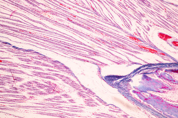 Anatomy and Histological Bone, Elastic cartilage human and Joint of human foetus under the microscope for education.