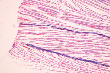 Anatomy and Histological Bone, Elastic cartilage human and Joint of human foetus under the microscope for education.