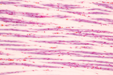 Anatomy and Histological Bone, Elastic cartilage human and Joint of human foetus under the...