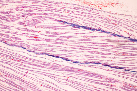 Anatomy and Histological Bone, Elastic cartilage human and Joint of human foetus under the microscope for education.
