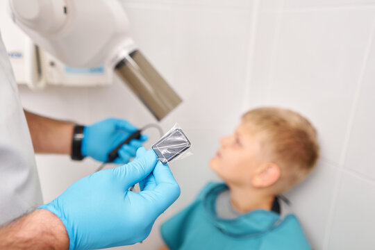 the sensor is individually packaged. close-up. Radiographer taking teeth radiography to a boy using digital x-ray machine in pediatric dental clinic. 