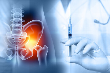 Injection for hip arthritis. Hip joint injections. 3d illustration