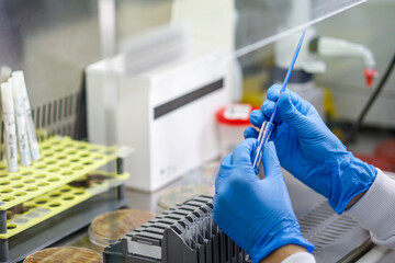 due mani con i guanti campioni delle azioni di ricerca di batteri in un laboratorio chimico 