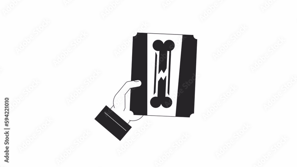 Poster holding bone x ray scan bw animation. orthopedic trauma isolated 2d flat monochromatic thin line fir