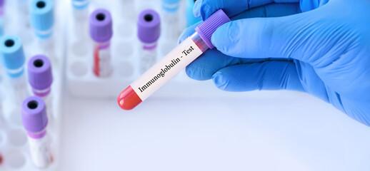Naklejka premium Doctor holding a test blood sample tube with Immunoglobulin test on the background of medical test tubes with analyzes.Banner