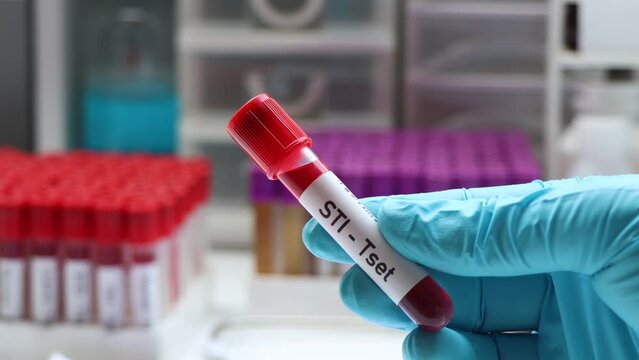 STI test to look for abnormalities from blood,  blood sample to analyze in the laboratory, blood in test tube