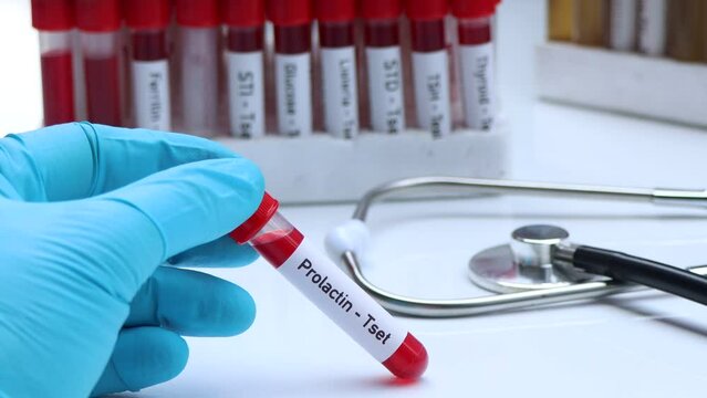 Prolactin test to look for abnormalities from blood,  blood sample to analyze in the laboratory, blood in test tube