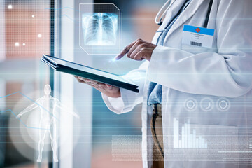 Doctor, woman with tablet in hands and hologram with medical data, anatomy and lung x ray with overlay. Technology research in healthcare, futuristic and analytics with person and wireless tech