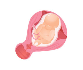 Concept Female anatomy uterus pregnancy. Using a cartoonish design and a flat style, this illustration showcases the step-by-step process of fetal development during pregnancy. Vector illustration.