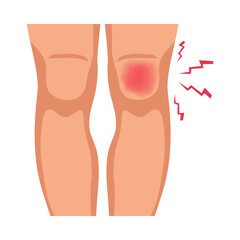Knee Injury Illustration