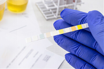 urinalysis with reagent strips to analyze Leukocytes, Urobilinogen, Bilirubin, Blood, Nitrite, pH, Density, Protein, Glucose and Ketosis bodies.