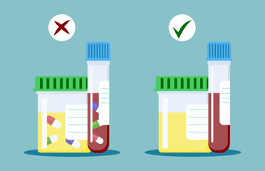 Laboratory test tubes with caps. Doping concept poster. Analysis for the maintenance of medicines in the blood and urine