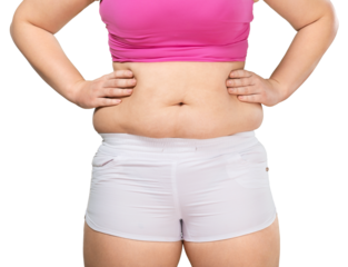 Overweight lady standing with stomach exposed