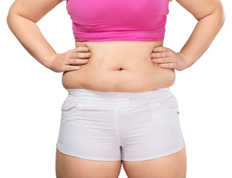 Overweight lady standing with stomach exposed