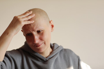 Bald woman touching head with hand, suffering from headache after chemotherapy. Unhappy hairless...