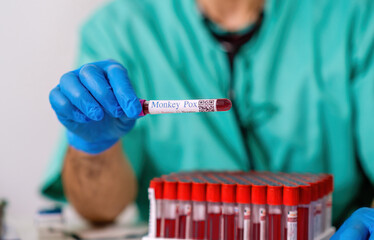 doctor holding a Monkey Pox blood test tube. Analysis concept. 