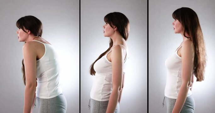 Head Forward Posture, Lordosis, Kyphosis
