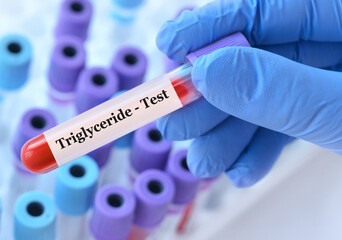 Doctor holding a test blood sample tube with Triglyceride test on the background of medical test...