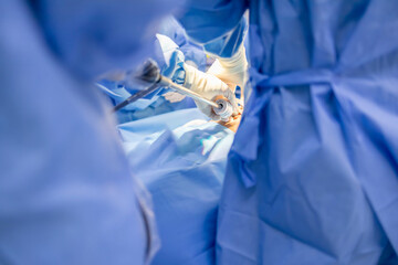 Doctor or surgeon in blue gown inserts camera device inside operating room in hospital.People did...