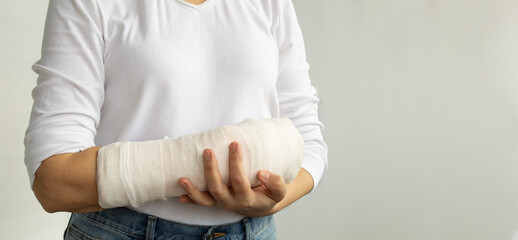 Close-up of a woman's broken arm in a cast. The girl holds a bent arm against the background of a white T-shirt. Banner, copy space.