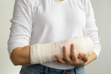 Close-up of a woman's broken arm in a cast. The girl holds a bent arm against the background of a white T-shirt. Appropriate treatment in Western medicine.