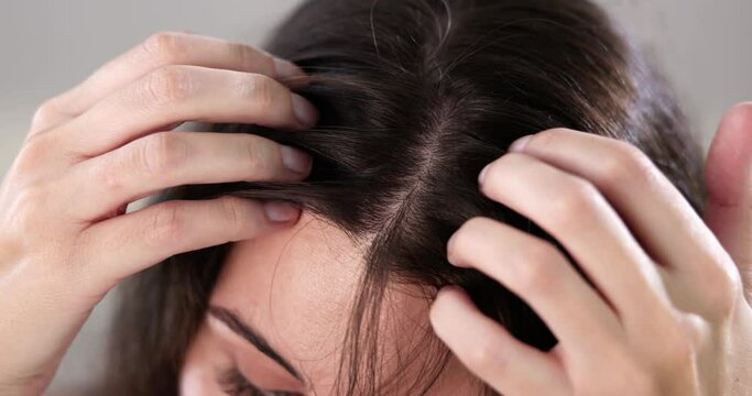 Hair Dandruff And Itchy Scalp Problem